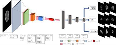 A Deep Learning Model for Preoperative Differentiation of Glioblastoma, Brain Metastasis and Primary Central Nervous System Lymphoma: A Pilot Study